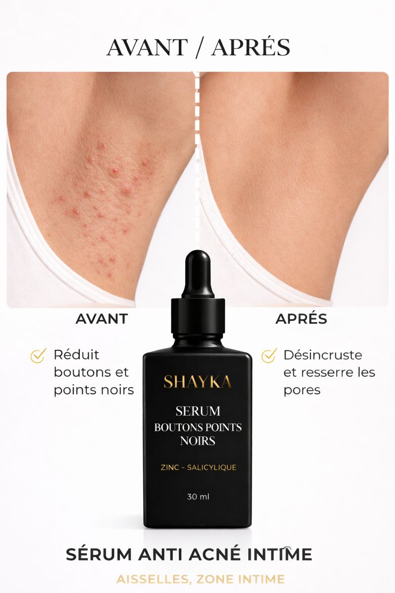 Serum anti boutons