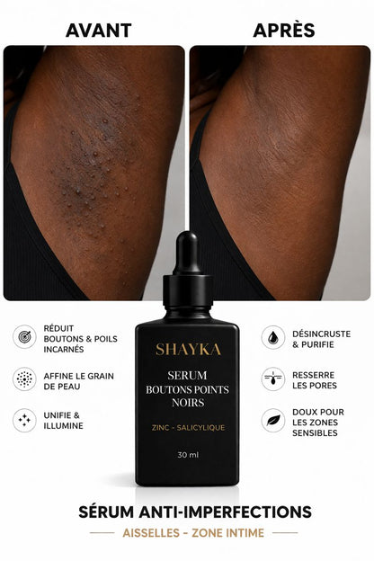 Serum anti boutons